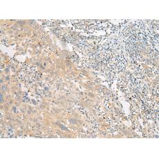 兔抗MSRB1多克隆抗體