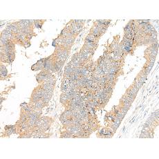 兔抗MSRB1多克隆抗體