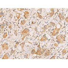 兔抗RAB38多克隆抗體  