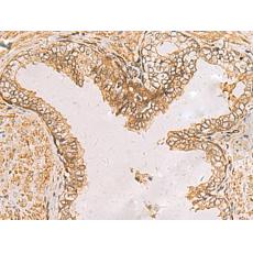 兔抗RAB38多克隆抗體  