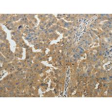 兔抗SYT6多克隆抗體