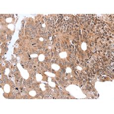  兔抗WDHD1多克隆抗體 